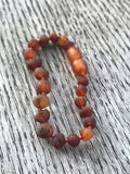 Baltic amber teething anklet